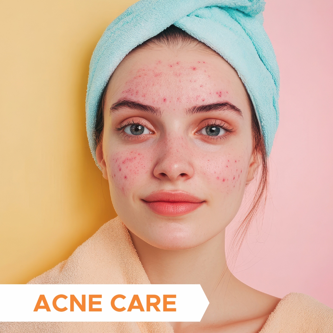 Acne Care