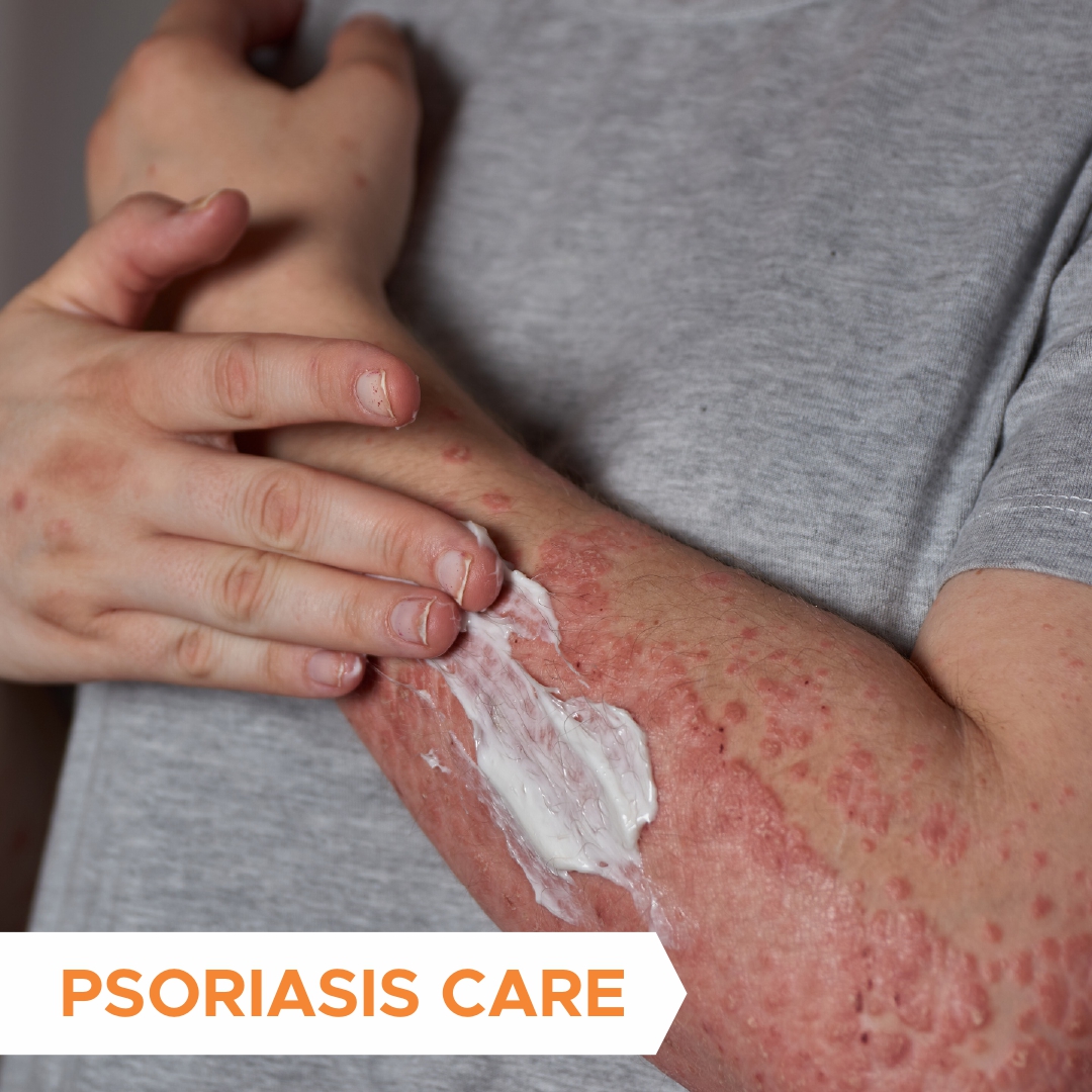 Psoriasis Care